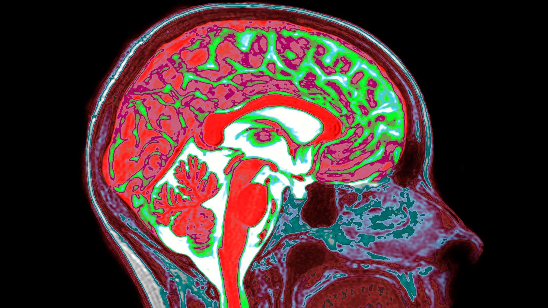 Estrogen's Surprising Role in Trauma and Memory: New Insights from Mouse Brain Research