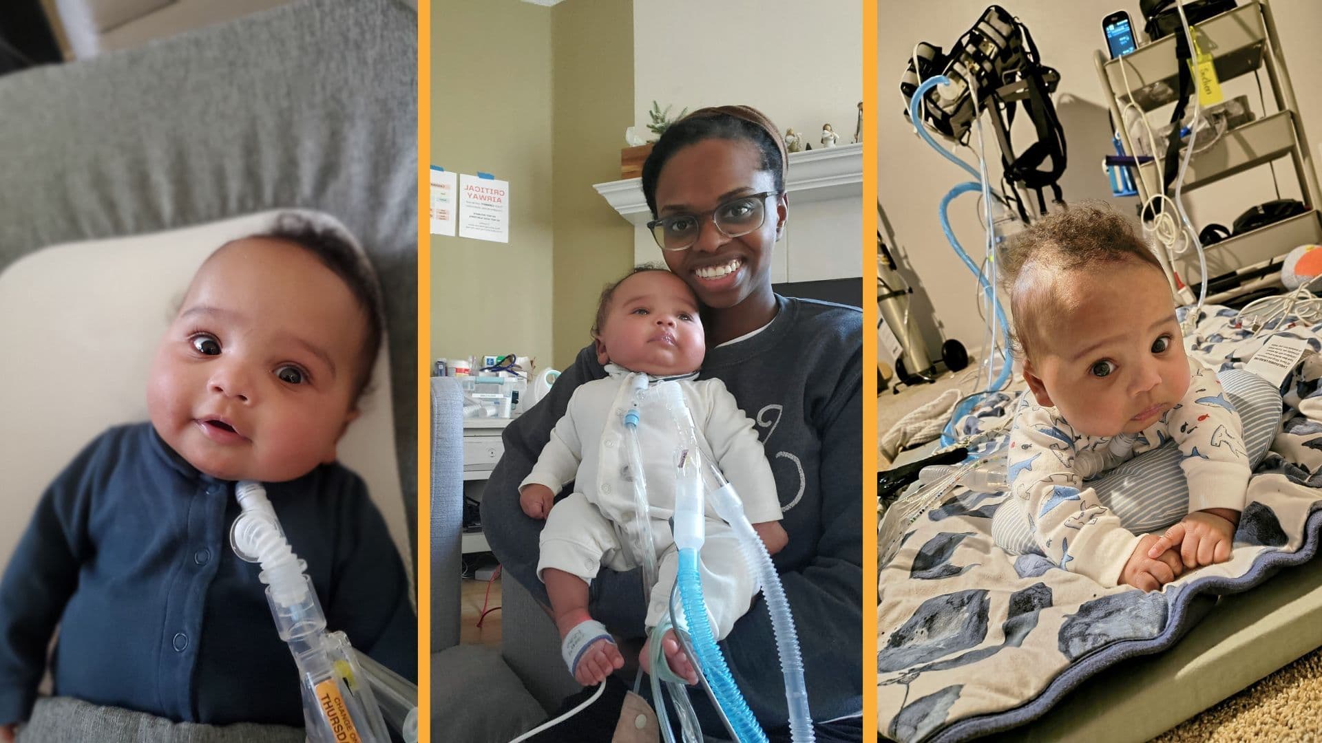 Groundbreaking Surgery at 25 Weeks Saves Baby from Fatal Lung Disorder