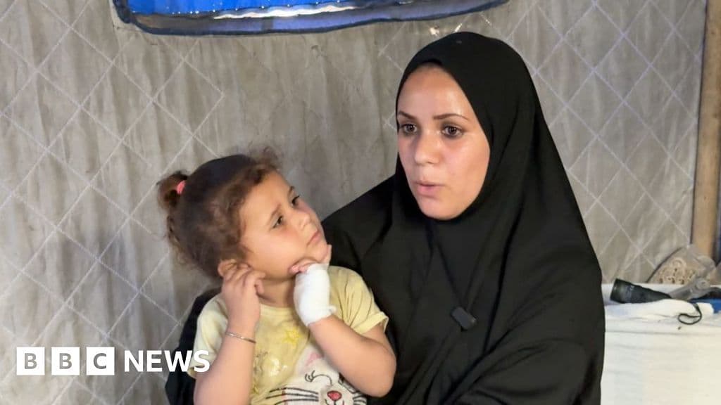 Gaza enfrenta una crisis sanitaria: ratas y comadrejas invaden campamentos de desplazados