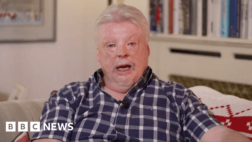 Veterano de Malvinas espera que el Rey Carlos III calme la tensión con Trump sobre la soberanía